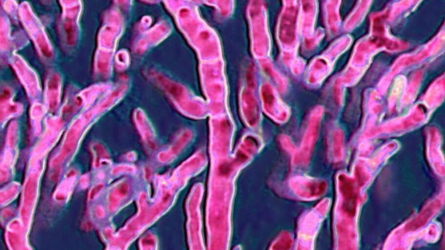 9103c450 734b 11f0 9d9a ffbe859066bf