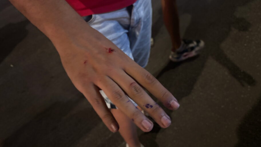 Eskalacija protesta u Nišu: Probijanje kordona, povređeni studenti i jaja za prostorije SPS-a 5 db0918a7 5cfe 4c40 94af ab4efae2f0aa