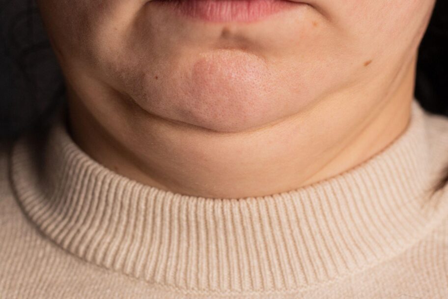 412fdf50 ab5d 11f0 b0f1 8b73bbc9408d