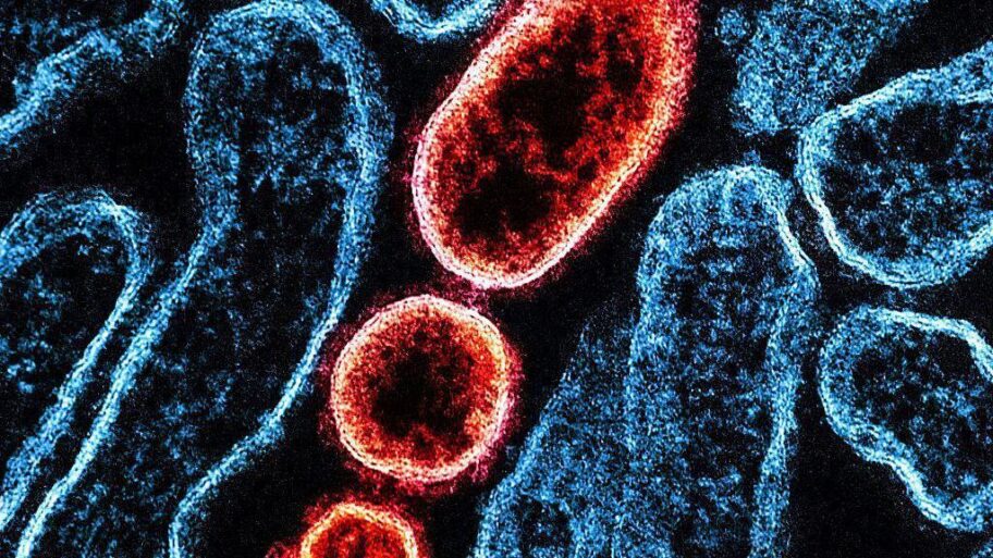 a1385700 fb68 11f0 83af ab051067462e